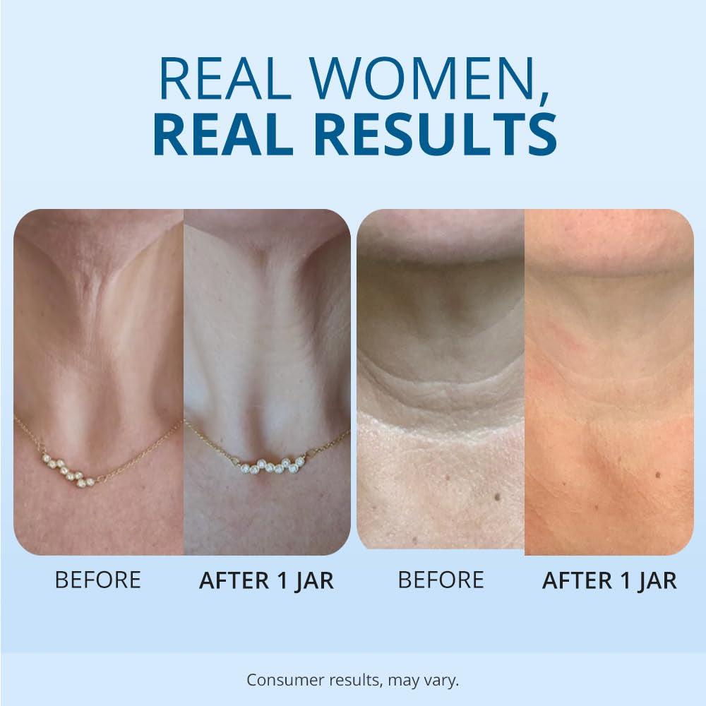 Elite Tighten and Lift Neck Cream- Clinically Tested